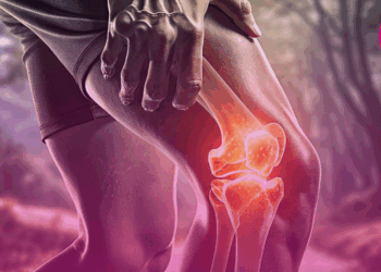 Dor nas articulações? Ortopedista revela 6 mitos sobre a artrose