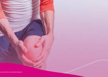 Esta dor no joelho ao acordar pode ser artrose e tem tratamento simples