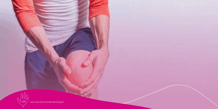 Esta dor no joelho ao acordar pode ser artrose e tem tratamento simples