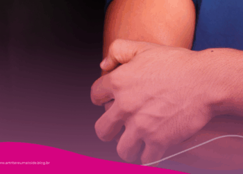 Reumatismo atinge milhões, mas evolui em silêncio