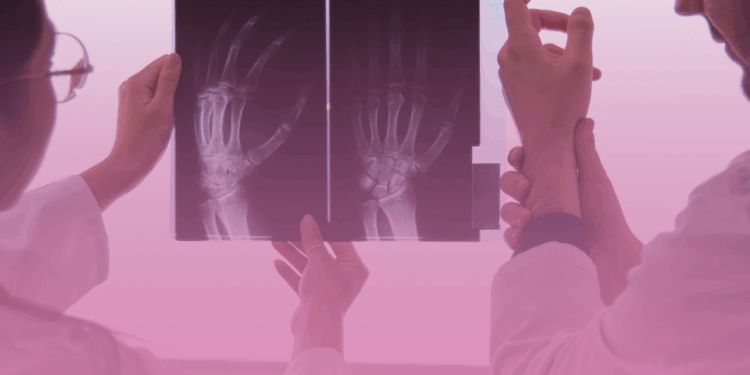 Projeto pretende incluir a artrite reumatoide na lista de doenças que garantem isenção de Imposto de Renda para aposentados