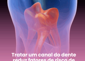 Tratar um canal do dente reduz fatores de risco de diabetes, diz estudo