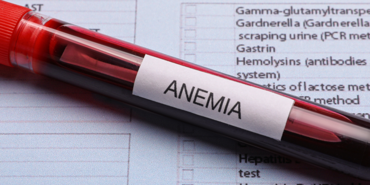 O perigo de tratar anemia sem investigar: doenças podem passar despercebidas