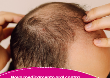Novo medicamento oral contra queda de cabelo promete maior eficácia e menos riscos à saúde