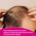 Novo medicamento oral contra queda de cabelo promete maior eficácia e menos riscos à saúde