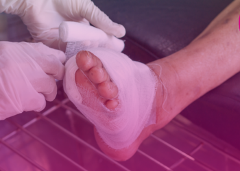 Consulta Pública nº 02/2026 – proposta de incorporação do transplante de membrana amniótica para o tratamento de pacientes com feridas crônicas e do pé diabético