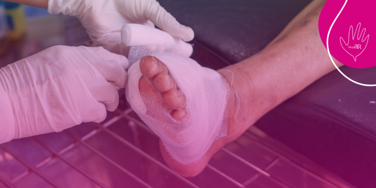 Consulta Pública nº 02/2026 – proposta de incorporação do transplante de membrana amniótica para o tratamento de pacientes com feridas crônicas e do pé diabético