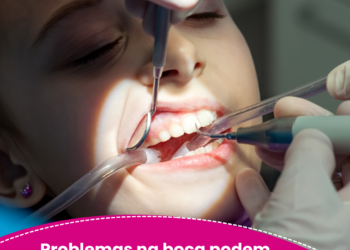 Problemas na boca podem indicar doenças autoimunes