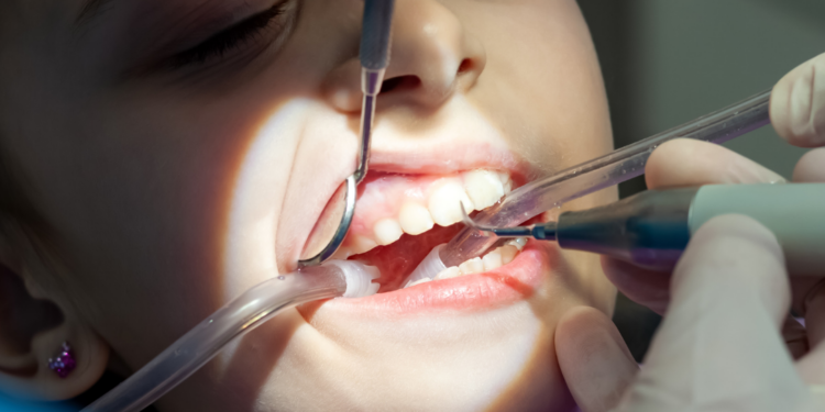 Problemas na boca podem indicar doenças autoimunes