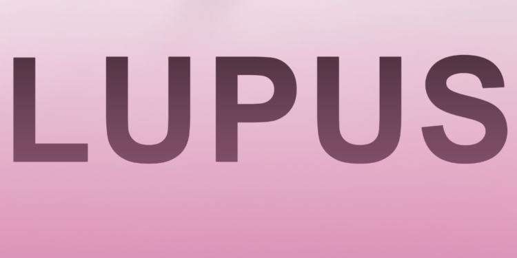 Apresentado parecer favorável ao projeto que cria a Carteira de Identificação da Pessoa com Lúpus