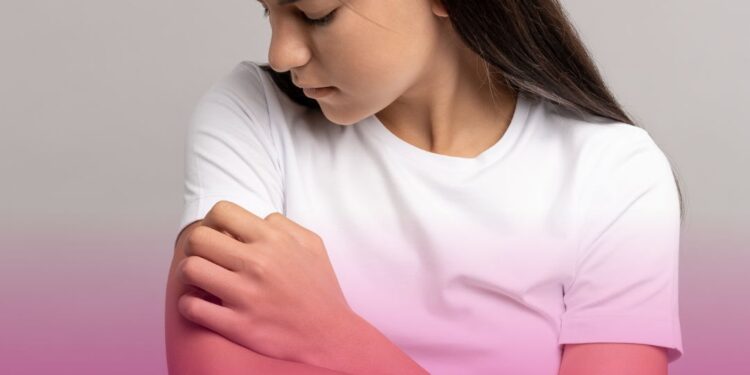 ANS aprova atualização do Rol de Procedimentos com incorporação de medicamentos para dermatite atópica e hemofilia A, além da atualização de PCDTs