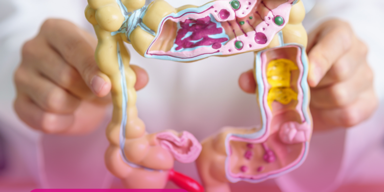 Câncer colorretal é a principal causa de morte por câncer em jovens nos EUA