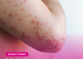 Rede global de virologistas alerta para ressurgimento do sarampo em meio ao pior surto da doença em 30 anos nos EUA