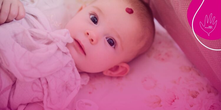 Conitec abre consulta pública para atualização do PCDT de Hemangioma Infantil