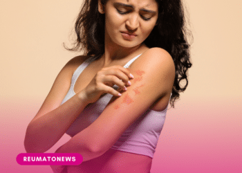 Pocah adia festa da filha por crise de psoríase da menina: ‘Não conseguia andar’