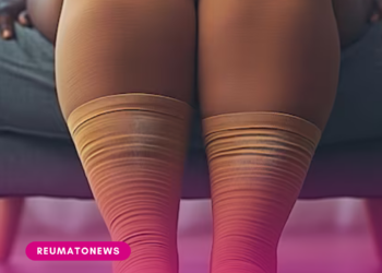 Todo mundo tem lipedema? Médicos criticam o excesso de diagnósticos e a venda de falsas soluções