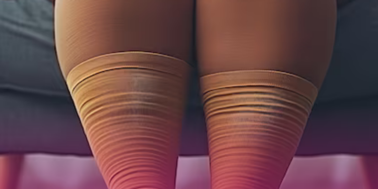 Todo mundo tem lipedema? Médicos criticam o excesso de diagnósticos e a venda de falsas soluções