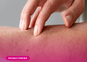 Síndrome de Alagille: doença rara impacta saúde mental e financeira