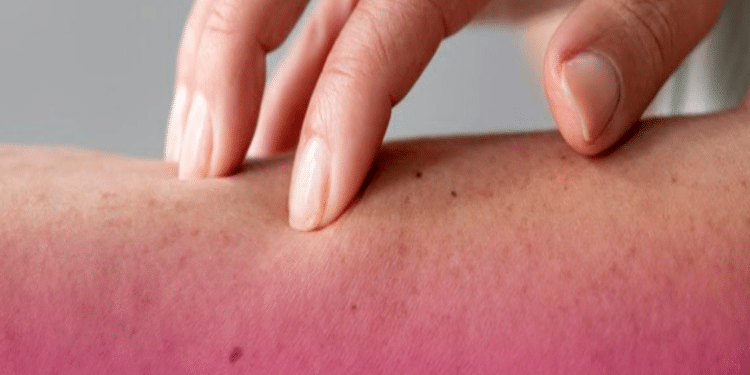 Síndrome de Alagille: doença rara impacta saúde mental e financeira