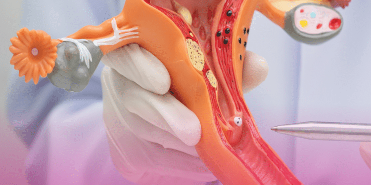 Clínica Elsimar Coutinho alerta no Março Lilás: câncer do colo do útero ainda causa mais de 7 mil mortes por ano no Brasil