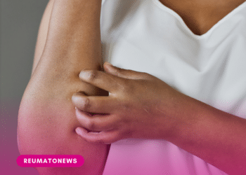 Coceira: pesquisadores descobrem mecanismo no cérebro que interrompe a sensação