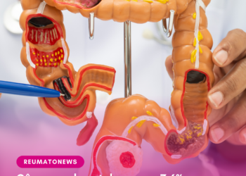 Câncer colorretal cresce 7,6% ao ano entre adultos jovens no Brasil, aponta A.C.Camargo