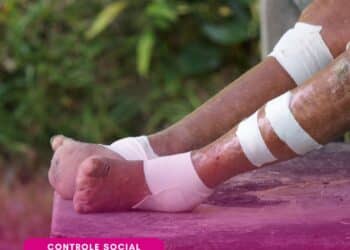 Conitec abre novas consultas públicas sobre tratamentos para leishmaniose, hanseníase, Parkinson e leiomioma de útero no SUS