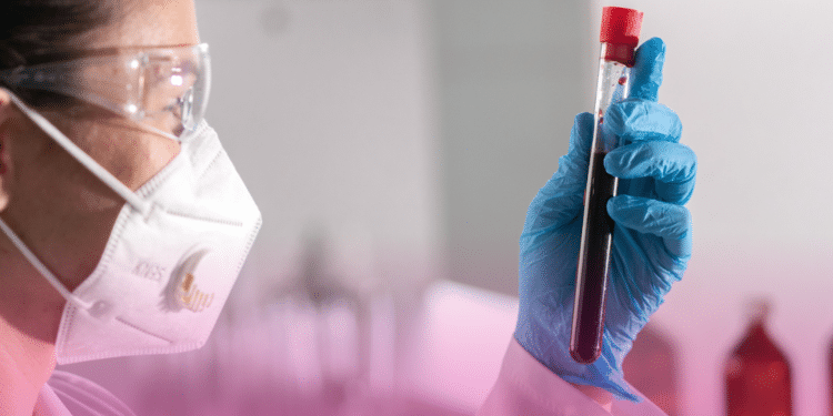 Novo exame de sangue com IA mostra o risco de 6 doenças cardiovasculares até 15 anos antes do sintomas