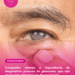 Campanha reforça a importância do diagnóstico precoce do glaucoma, que não apresenta sintomas nas fases iniciais