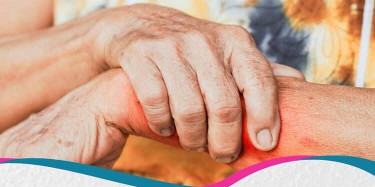 EULAR 2026: Atualizações sobre lúpus e síndrome antifosfolípide: novos tratamentos, diagnóstico e cuidados para melhorar a qualidade de vida dos pacientes