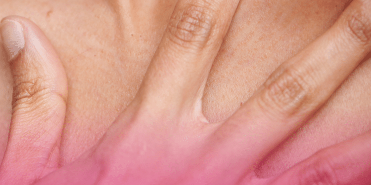 Dia Mundial da Saúde da Pele: doenças cutâneas afetam quase 5 bilhões de pessoas e jovens brasileiros recorrem às redes sociais antes do dermatologista