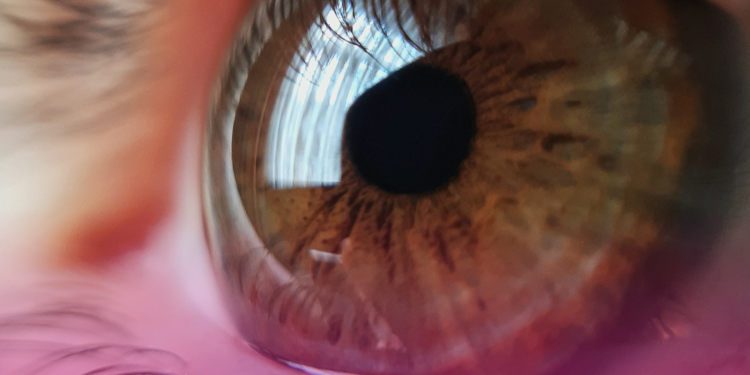 Uso indiscriminado de corticoides pode causar glaucoma e cegueira