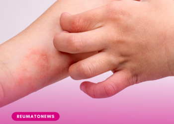 Dia da Dermatite Atópica: Doença inflamatória crônica da pele impacta na qualidade de vida dos pacientes e convívio social