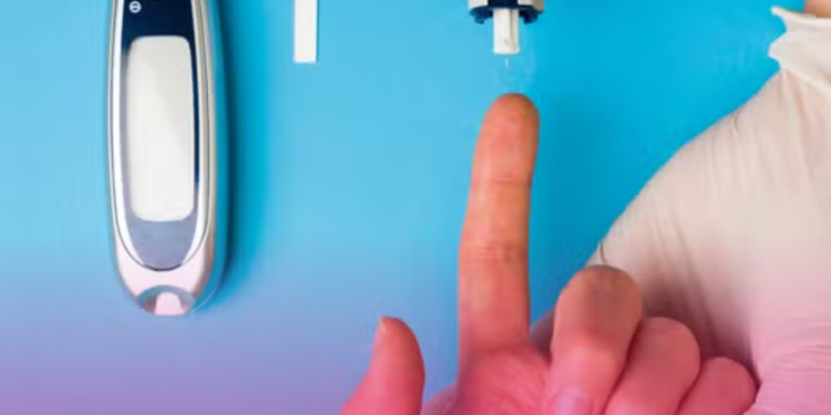 Cirurgia ‘Gêmea’ da bariátrica trata diabetes tipo 2 e controla a doença em até 89% dos casos