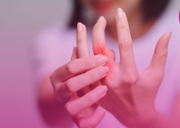 Artrite reumatoide: guia com o passo a passo para uma vida mais leve