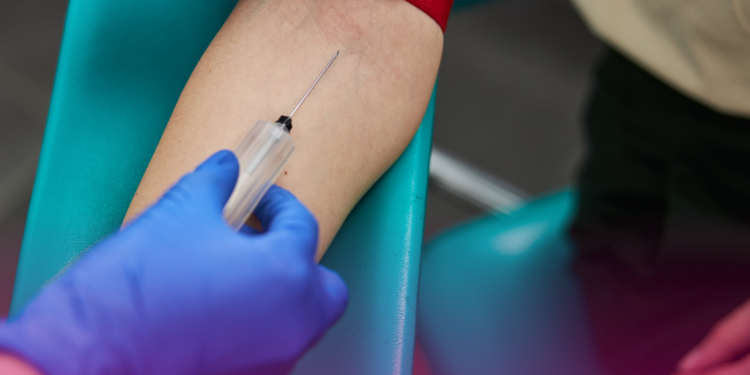 Anvisa aprova exame de sangue para diagnosticar Doença de Alzheimer